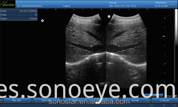 image for labtop ultrasound